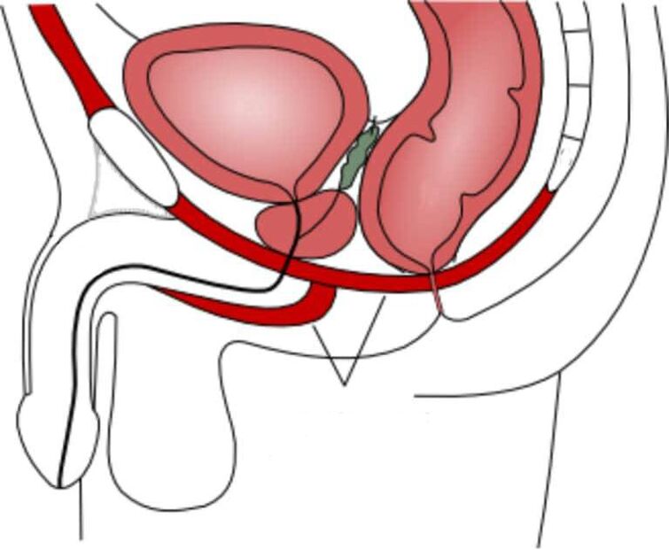 entrenar los músculos del suelo pélvico para mejorar la potencia